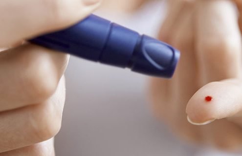 Che Cos'è il Diabete e Da Cosa è Causato?