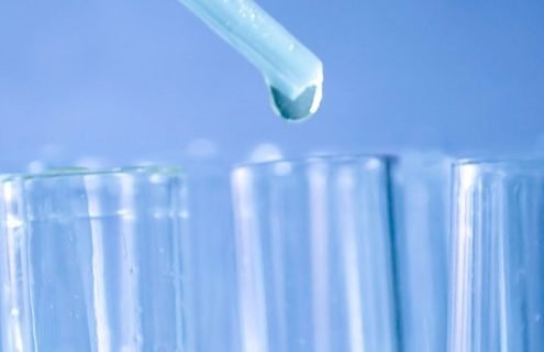 Test delle urine (glicosuria)