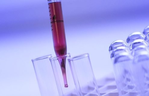 Valori di riferimento della glicemia o glucosio nel sangue- Diabete.com