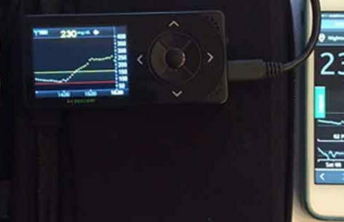 iMove: nuovo dispositivo hightech che “veglia” sui bambini diabetici
