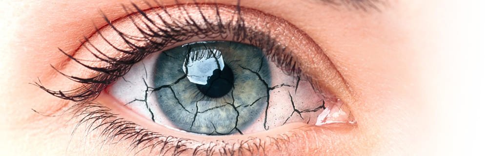 Diabete.com - Occhio secco: quando il film lacrimale è alterato