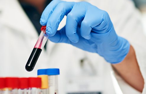 La curva da carico di glucosio: da un vecchio test, nuove indicazioni più precise per la diagnosi di diabete