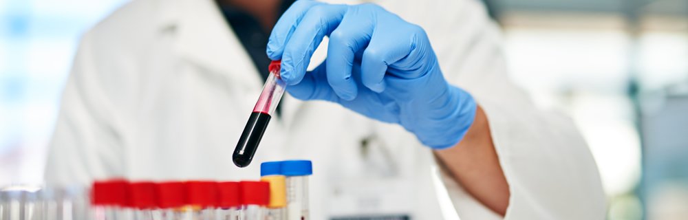 La curva da carico di glucosio: da un vecchio test, nuove indicazioni più precise per la diagnosi di diabete