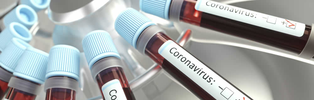 AIFA: istituita la nuova “Unità di crisi Coronavirus”