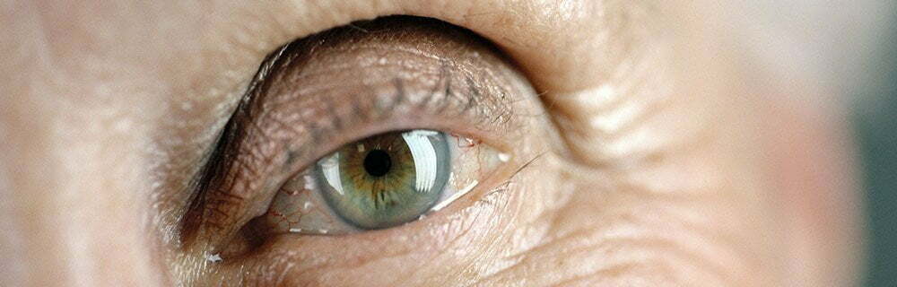 Maculopatia e COVID 19: le cure non vanno abbandonate, gli ospedali sono sicuri