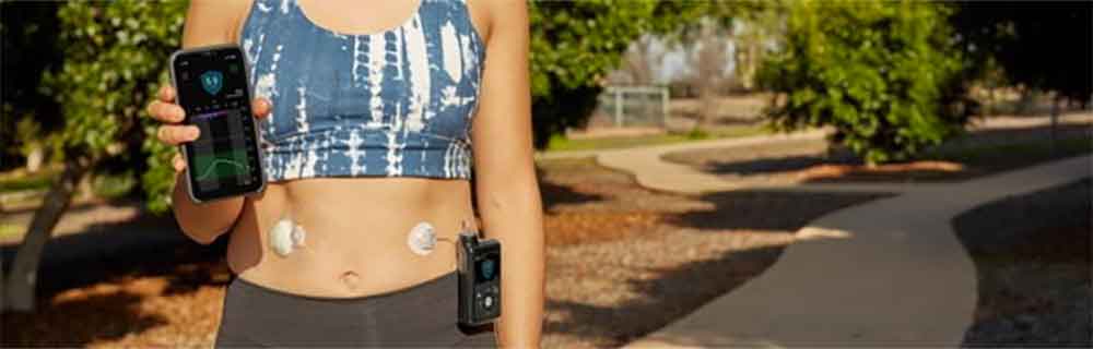 Minimed 780G, il sistema automatizzato per l’infusione di insulina
