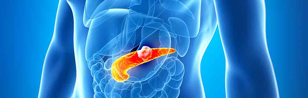 Diabete.com - Pancreas Artificiale Bionico Impiantabile