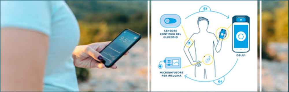 DBLG1 System, il nuovo sistema ibrido ad ansa chiusa per la somministrazione automatizzata di Insulina - Diabete.com