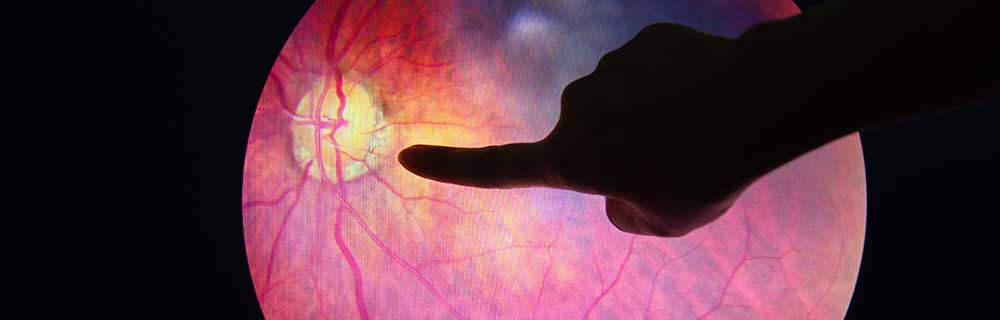 Prevenzione e la cura della Retinopatia Diabetica: Meteda investe nell’intelligenza artificiale applicata all’oftalmologia