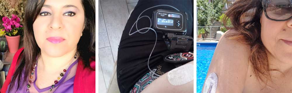 Diabete tipo 1: la mia storia di straordinaria “DIVERSITÁ”