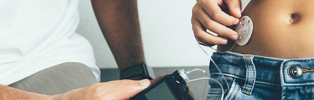 Tecnologia e Terapia per il diabete tipo 1: approvate le nuove Linee Guida AMD, SID e SIEDP