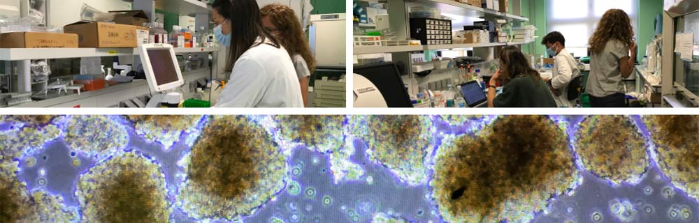 Terapia cellulare: come tratteremo il diabete tipo 1
