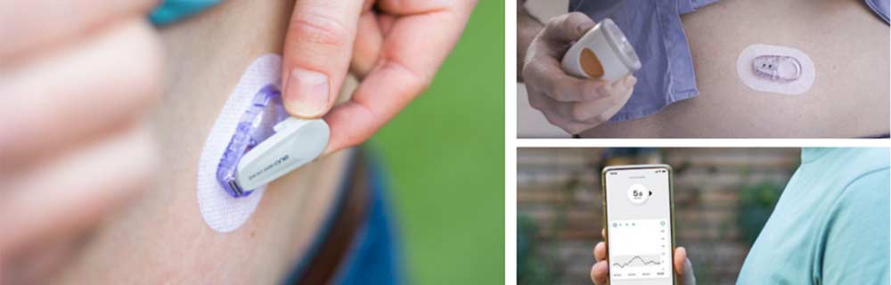 Disponibile in Italia il nuovo sistema DEXCOM ONE CGM per chi è in cura con insulina