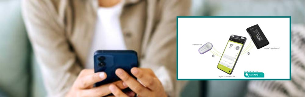 MylifeTM Loop: il primo sistema basato sul cellulare per l’erogazione automatizzata di insulina