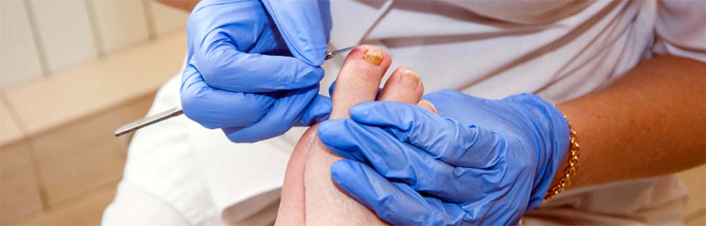 Piede diabetico: in Lombardia 17 centri per prevenzione, diagnosi e cura