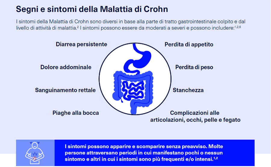 Segni e sintomi della malattia di Crohn
