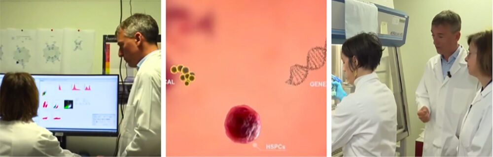 Immunostem, in studio la nuova frontiera contro il diabete tipo 1